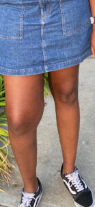 knee lump
